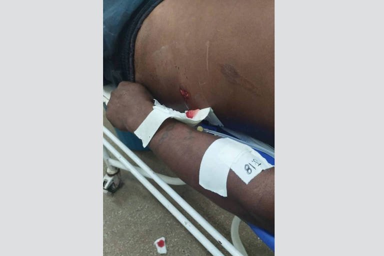 Conflito no Amazonas: Homem Morre Após Flechada, Outro Ferido - Imagem do artigo original