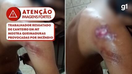 Resgate em MT: 96% dos trabalhadores negros explorados - Imagem do artigo original