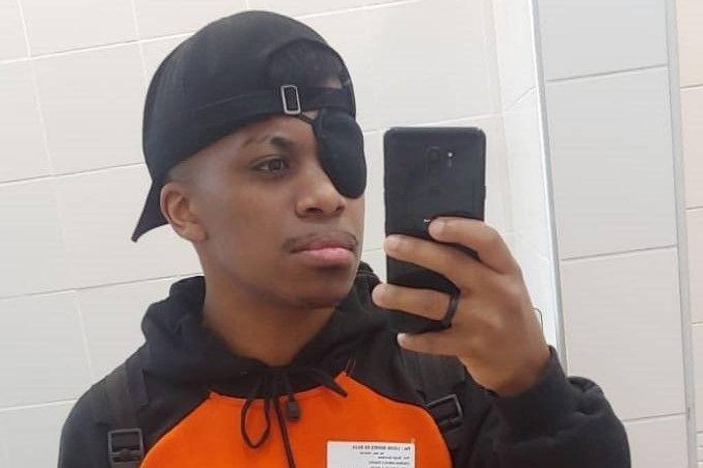 Próteses Gratuitas Transformam Vida Pós-Câncer Facial - Imagem do artigo