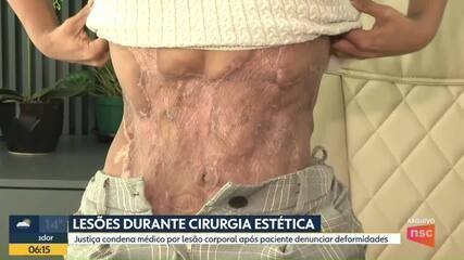 Médico é Condenado Após Graves Lesões em Cirurgias Plásticas - Imagem do artigo original