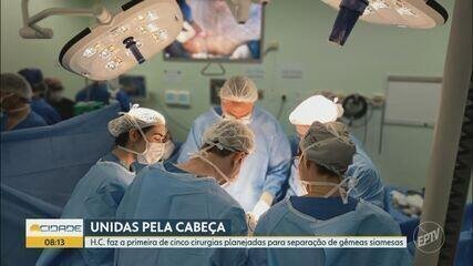 HC Ribeirão Realiza 2ª Etapa Crucial de Cirurgia Siamesas - Imagem do artigo original
