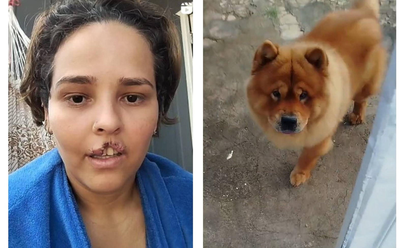 Natani Santos Supera Trauma de Ataque de Cachorro em RO - Imagem do artigo