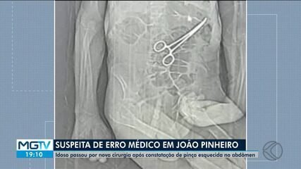 Erro Médico em João Pinheiro: Pinça Esquecida na Cirurgia - Imagem do artigo original