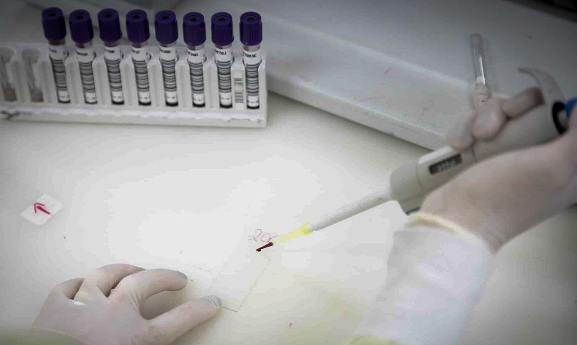 Exames Descartam Ebola em Imigrante do Congo em SP - Imagem do artigo original
