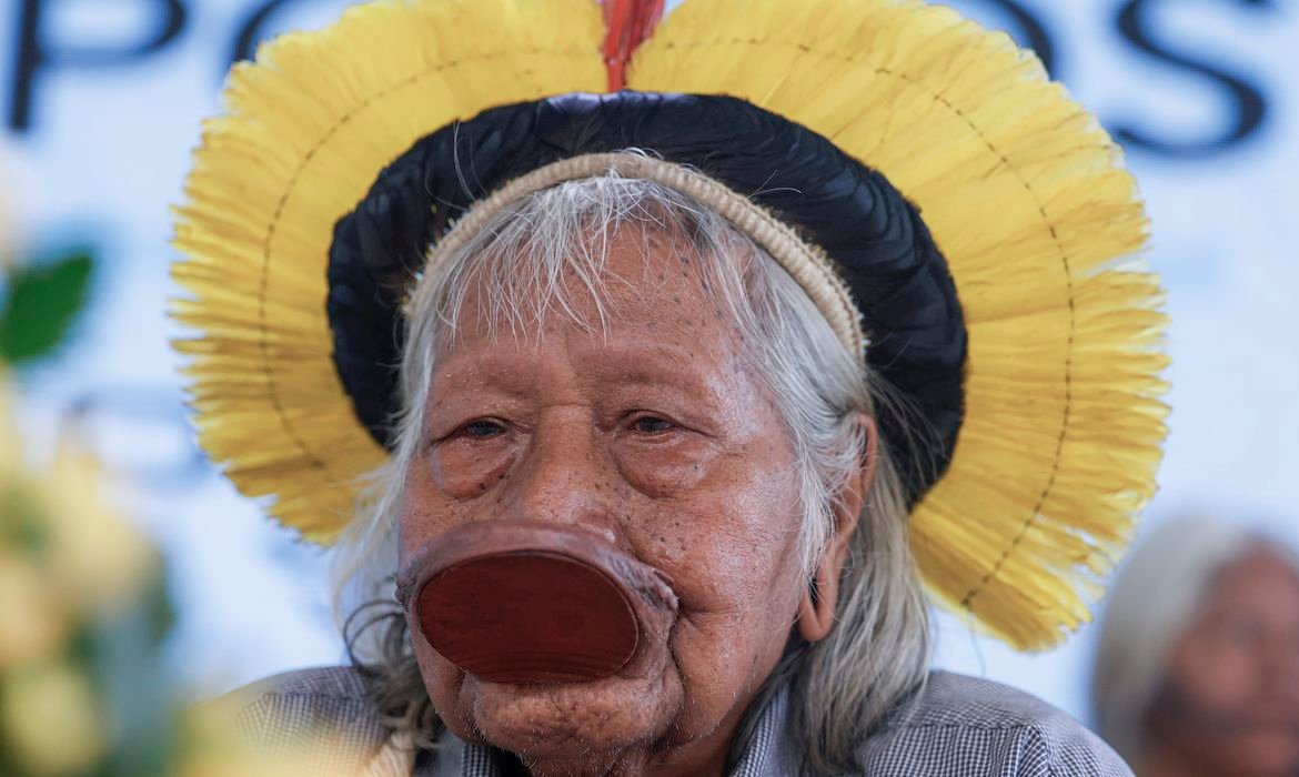 Cacique Raoni na UTI Mostra Melhora Discreta em Sinop - Imagem do artigo original