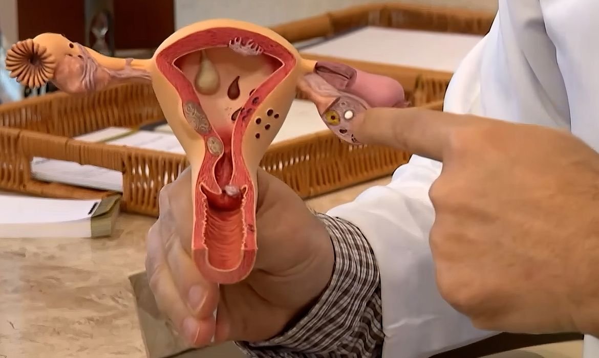 CNPq lança chamada para pesquisas sobre endometriose e saúde menstrual - Imagem do artigo original