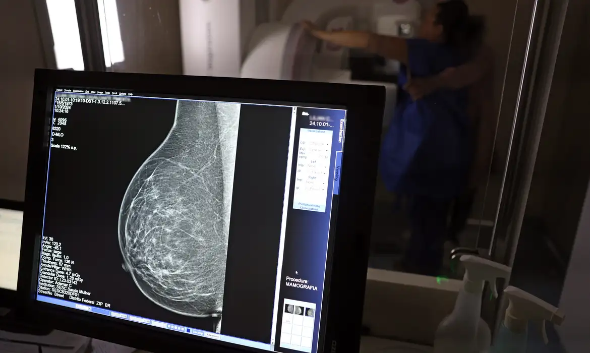 Cobertura Obrigatória de Mamografia Digital por Planos - Imagem do artigo original