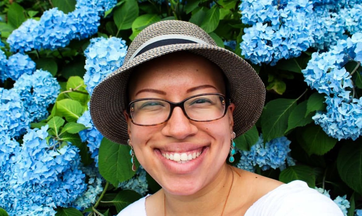 Alopecia Areata: Desafios e Superação na Busca por Autoestima - Imagem do artigo original